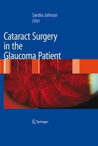 Produktbild: Cataract Surgery in the Glaucoma Patient