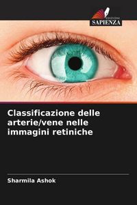 Produktbild: Classificazione delle arterie/vene nelle immagini retiniche