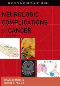 Produktbild: Neurologic Complications of Cancer