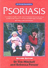 Produktbild: Mitchell, T: Psoriasis