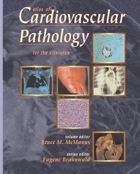 Produktbild: Atlas Of Cardiovascul -Nop/024