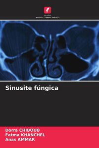 Produktbild: Sinusite f&uacute;ngica
