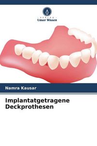 Produktbild: Implantatgetragene Deckprothesen