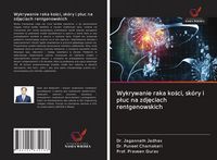 Produktbild: Wykrywanie raka ko&iquest;ci, sk&oacute;ry i p&iquest;uc na zdj&iquest;ciach rentgenowskich