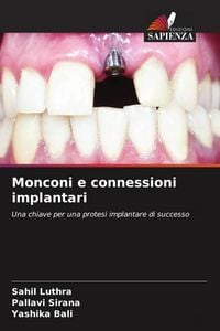 Produktbild: Monconi e connessioni implantari