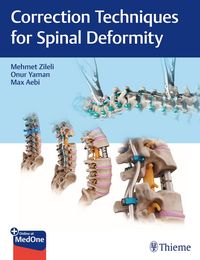 Produktbild: Correction Techniques for Spinal Deformity