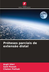 Produktbild: Pr&oacute;teses parciais de extens&atilde;o distal