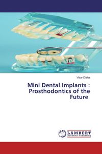 Produktbild: Mini Dental Implants : Prosthodontics of the Future