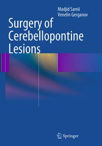 Produktbild: Surgery of Cerebellopontine Lesions