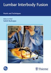 Produktbild: Lumbar Interbody Fusion