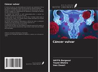 Produktbild: C&aacute;ncer vulvar