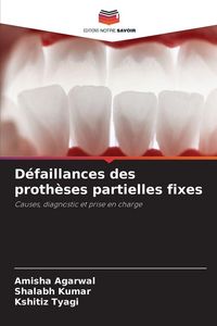 Produktbild: D&eacute;faillances des proth&egrave;ses partielles fixes