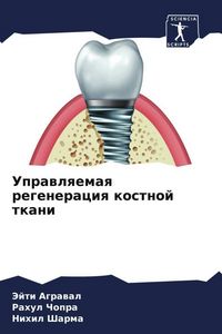 Produktbild: Uprawlqemaq regeneraciq kostnoj tkani
