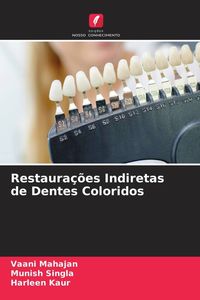 Produktbild: Restaura&ccedil;&otilde;es Indiretas de Dentes Coloridos