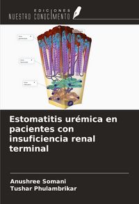 Produktbild: Estomatitis ur&eacute;mica en pacientes con insuficiencia renal terminal