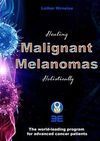 Produktbild: Malignant Melanomas