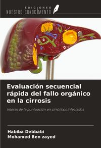 Produktbild: Evaluaci&oacute;n secuencial r&aacute;pida del fallo org&aacute;nico en la cirrosis