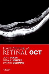 Produktbild: Handbook of Retinal OCT: Optical Coherence Tomography E-Book