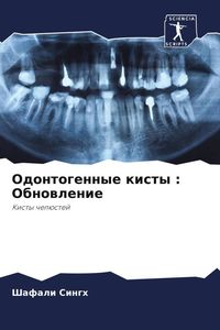 Produktbild: Odontogennye kisty : Obnowlenie