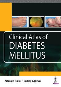 Produktbild: Clinical Atlas of Diabetes Mellitus