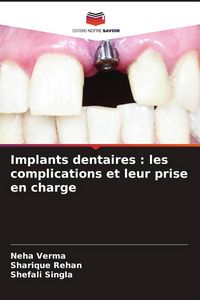 Produktbild: Implants dentaires : les complications et leur prise en charge