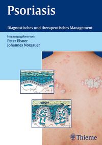 Produktbild: Psoriasis