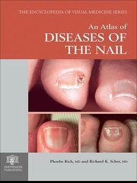 Produktbild: An Atlas of Diseases of the Nail