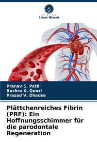 Produktbild: Pl&auml;ttchenreiches Fibrin (PRF): Ein Hoffnungsschimmer f&uuml;r die parodontale Regeneration