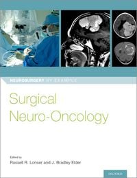 Produktbild: Surgical Neuro-Oncology