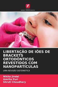 Produktbild: Liberta&ccedil;&atilde;o De I&otilde;es De Brackets Ortod&ocirc;nticos Revestidos Com Nanopart&iacute;culas