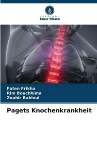 Produktbild: Pagets Knochenkrankheit
