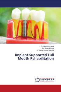 Produktbild: Implant Supported Full Mouth Rehabilitation
