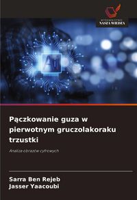 Produktbild: P&iquest;czkowanie guza w pierwotnym gruczolakoraku trzustki