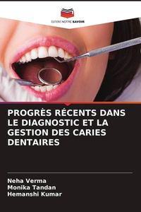 Produktbild: Progr&egrave;s R&eacute;cents Dans Le Diagnostic Et La Gestion des Caries Dentaires