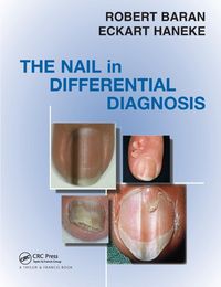 Produktbild: The Nail in Differential Diagnosis