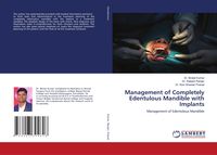 Produktbild: Management of Completely Edentulous Mandible with Implants