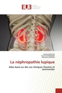 Produktbild: La n&eacute;phropathie lupique