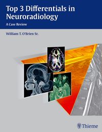 Produktbild: Top 3 Differentials in Neuroradiology