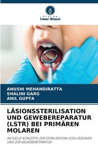 Produktbild: L&auml;sionssterilisation und Gewebereparatur (lstr) bei Prim&auml;ren Molaren