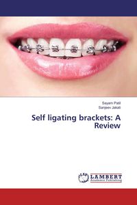 Produktbild: Self ligating brackets: A Review