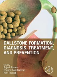Produktbild: Gallstone Formation, Diagnosis, Treatment and Prevention