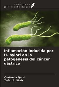 Produktbild: Inflamaci&oacute;n inducida por H. pylori en la patog&eacute;nesis del c&aacute;ncer g&aacute;strico