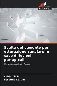 Produktbild: Scelta del cemento per otturazione canalare in caso di lesioni periapicali