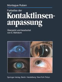 Produktbild: Farbatlas der Kontaktlinsenanpassung