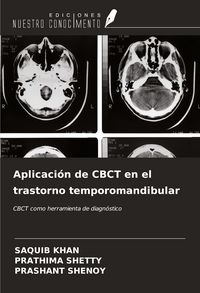 Produktbild: Aplicaci&oacute;n de CBCT en el trastorno temporomandibular