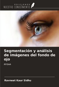 Produktbild: Segmentaci&oacute;n y an&aacute;lisis de im&aacute;genes del fondo de ojo