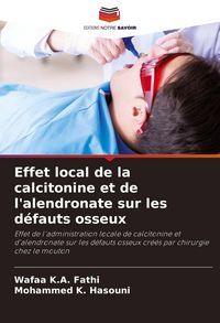 Produktbild: Effet local de la calcitonine et de l'alendronate sur les d&eacute;fauts osseux