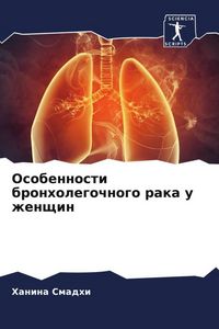 Produktbild: Osobennosti bronholegochnogo raka u zhenschin