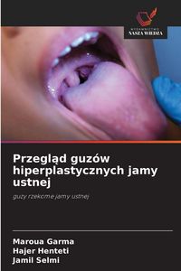 Produktbild: Przegląd guz&oacute;w hiperplastycznych jamy ustnej