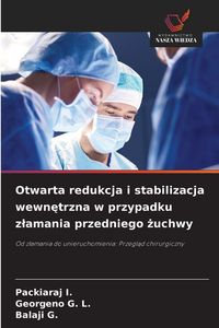Produktbild: Otwarta redukcja i stabilizacja wewn&iquest;trzna w przypadku z&iquest;amania przedniego &iquest;uchwy
